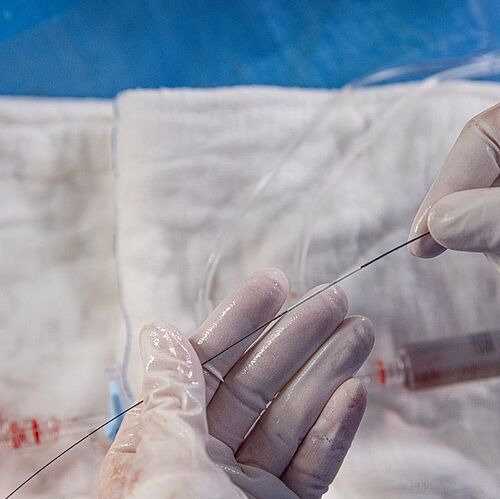 Stent