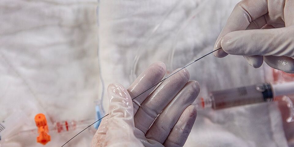 stent