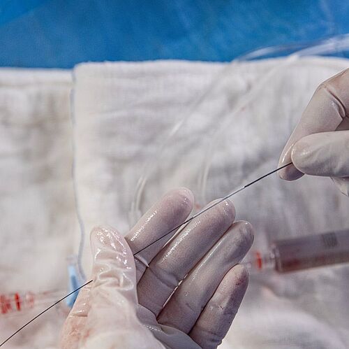 stent