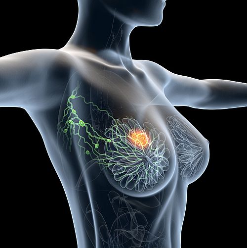 Illustration Axilla lymph nodes