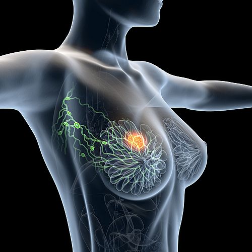 Illustration Axilla Lymphknoten