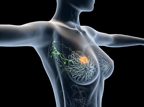 Illustration Axilla Lymphknoten