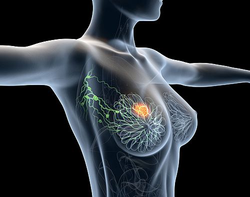 Illustration Axilla lymph nodes