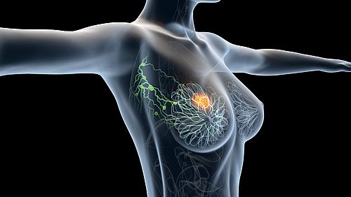 Illustration Axilla Lymphknoten